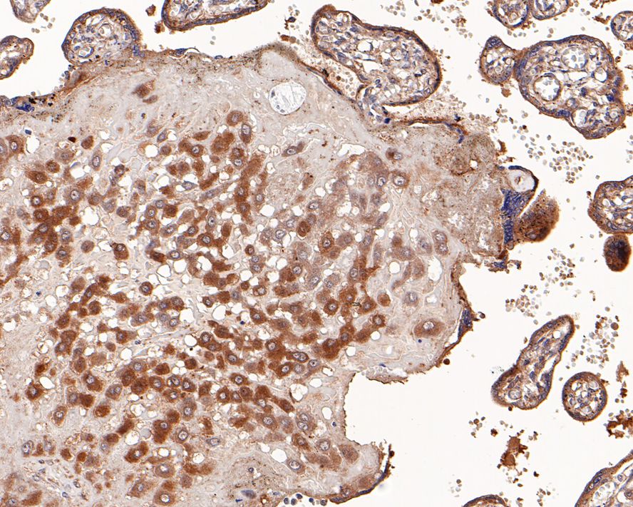 Immunohistochemical analysis of paraffin-embedded human placenta tissue with Mouse anti-ROBO1 antibody (EM1901-72) at 1/200 dilution.<br />
<br />
The section was pre-treated using heat mediated antigen retrieval with Tris-EDTA buffer (pH 9.0) for 20 minutes. The tissues were blocked in 1% BSA for 20 minutes at room temperature, washed with ddH2O and PBS, and then probed with the primary antibody (EM1901-72) at 1/200 dilution for 1 hour at room temperature. The detection was performed using an HRP conjugated compact polymer system. DAB was used as the chromogen. Tissues were counterstained with hematoxylin and mounted with DPX.