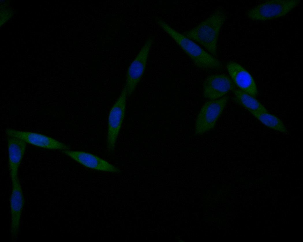 ICC staining of Annexin A3 in SiHa cells (green). Formalin fixed cells were permeabilized with 0.1% Triton X-100 in TBS for 10 minutes at room temperature and blocked with 1% Blocker BSA for 15 minutes at room temperature. Cells were probed with the primary antibody (EM1901-73, 1/50) for 1 hour at room temperature, washed with PBS. Alexa Fluor®488 Goat anti-Mouse IgG was used as the secondary antibody at 1/1,000 dilution. The nuclear counter stain is DAPI (blue).