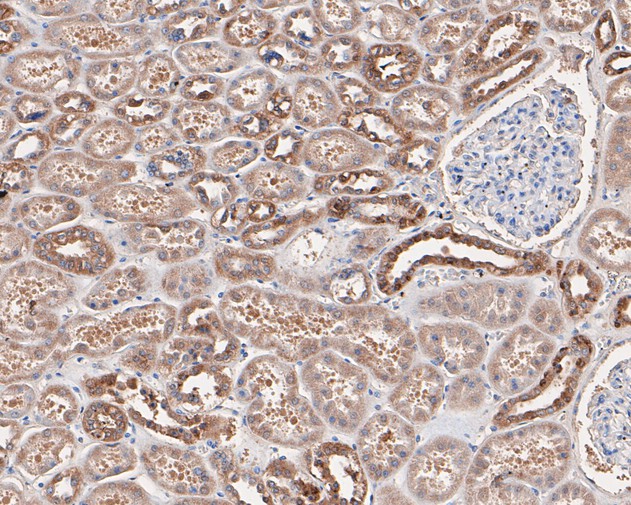 Immunohistochemical analysis of paraffin-embedded human kidney tissue using anti-Annexin A3 antibody. The section was pre-treated using heat mediated antigen retrieval with Tris-EDTA buffer (pH 8.0-8.4) for 20 minutes.The tissues were blocked in 5% BSA for 30 minutes at room temperature, washed with ddH2O and PBS, and then probed with the primary antibody (EM1901-73, 1/400) for 30 minutes at room temperature. The detection was performed using an HRP conjugated compact polymer system. DAB was used as the chromogen. Tissues were counterstained with hematoxylin and mounted with DPX.