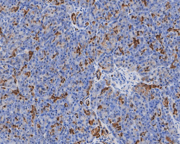 Immunohistochemical analysis of paraffin-embedded human pancreas tissue using anti-Annexin A3 antibody. The section was pre-treated using heat mediated antigen retrieval with Tris-EDTA buffer (pH 8.0-8.4) for 20 minutes.The tissues were blocked in 5% BSA for 30 minutes at room temperature, washed with ddH2O and PBS, and then probed with the primary antibody (EM1901-73, 1/400) for 30 minutes at room temperature. The detection was performed using an HRP conjugated compact polymer system. DAB was used as the chromogen. Tissues were counterstained with hematoxylin and mounted with DPX.