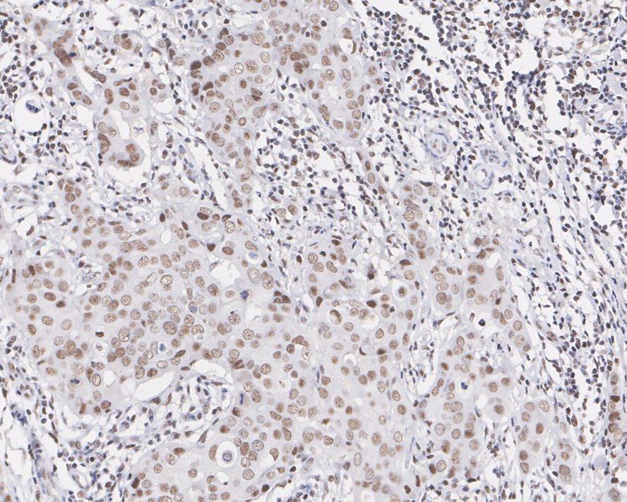 Immunohistochemical analysis of paraffin-embedded human tonsil tissue using anti-MTA2 antibody. The section was pre-treated using heat mediated antigen retrieval with sodium citrate buffer (pH 6.0) for 20 minutes. The tissues were blocked in 5% BSA for 30 minutes at room temperature, washed with ddH2O and PBS, and then probed with the primary antibody (EM1901-74, 1/1,000)  for 30 minutes at room temperature. The detection was performed using an HRP conjugated compact polymer system. DAB was used as the chromogen. Tissues were counterstained with hematoxylin and mounted with DPX.