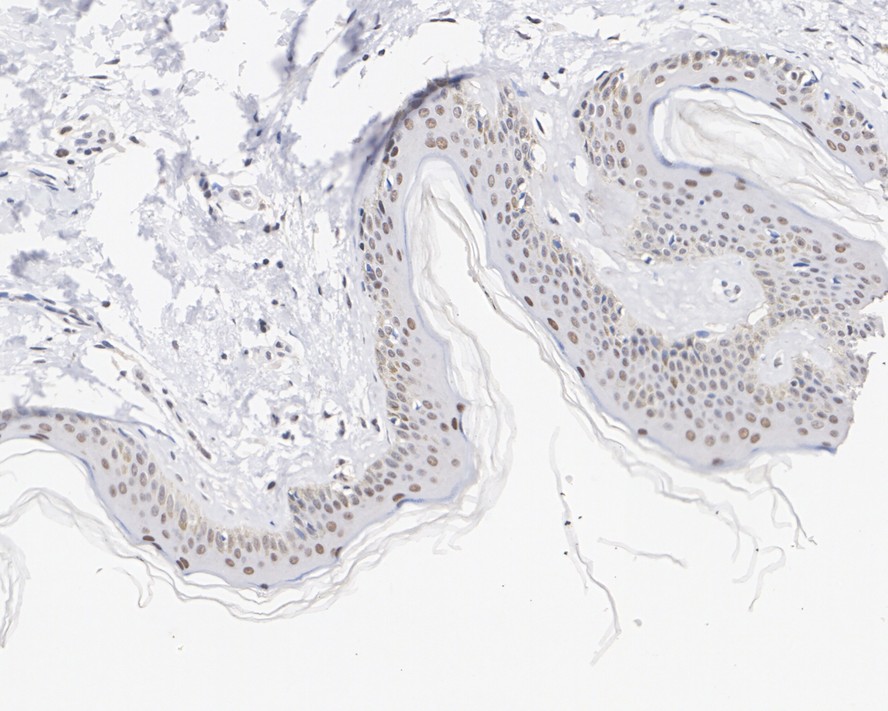 Immunohistochemical analysis of paraffin-embedded human skin tissue using anti-MTA2 antibody. The section was pre-treated using heat mediated antigen retrieval with sodium citrate buffer (pH 6.0) for 20 minutes. The tissues were blocked in 5% BSA for 30 minutes at room temperature, washed with ddH2O and PBS, and then probed with the primary antibody (EM1901-74, 1/1,000)  for 30 minutes at room temperature. The detection was performed using an HRP conjugated compact polymer system. DAB was used as the chromogen. Tissues were counterstained with hematoxylin and mounted with DPX.