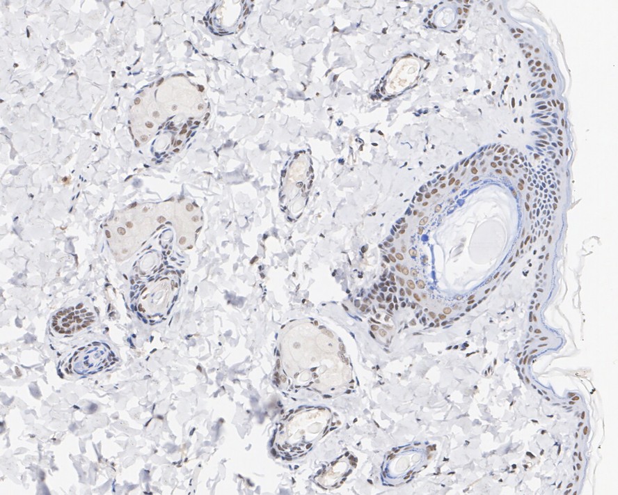Immunohistochemical analysis of paraffin-embedded human breast tissue using anti-MTA2 antibody. The section was pre-treated using heat mediated antigen retrieval with sodium citrate buffer (pH 6.0) for 20 minutes. The tissues were blocked in 5% BSA for 30 minutes at room temperature, washed with ddH2O and PBS, and then probed with the primary antibody (EM1901-74, 1/1,000)  for 30 minutes at room temperature. The detection was performed using an HRP conjugated compact polymer system. DAB was used as the chromogen. Tissues were counterstained with hematoxylin and mounted with DPX.