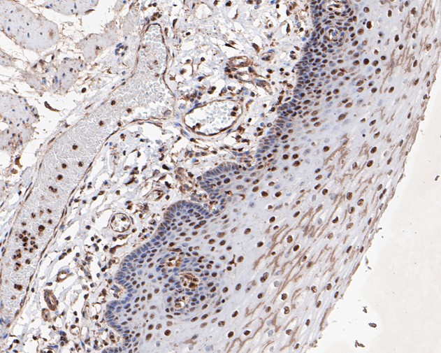 Immunohistochemical analysis of paraffin-embedded human esophagus tissue using anti-MTA2 antibody. The section was pre-treated using heat mediated antigen retrieval with sodium citrate buffer (pH 6.0) for 20 minutes. The tissues were blocked in 5% BSA for 30 minutes at room temperature, washed with ddH2O and PBS, and then probed with the primary antibody (EM1901-74, 1/1,000)  for 30 minutes at room temperature. The detection was performed using an HRP conjugated compact polymer system. DAB was used as the chromogen. Tissues were counterstained with hematoxylin and mounted with DPX.