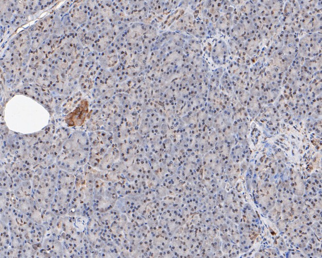 Immunohistochemical analysis of paraffin-embedded human pancreas tissue using anti-MTA2 antibody. The section was pre-treated using heat mediated antigen retrieval with sodium citrate buffer (pH 6.0) for 20 minutes. The tissues were blocked in 5% BSA for 30 minutes at room temperature, washed with ddH2O and PBS, and then probed with the primary antibody (EM1901-74, 1/1,000)  for 30 minutes at room temperature. The detection was performed using an HRP conjugated compact polymer system. DAB was used as the chromogen. Tissues were counterstained with hematoxylin and mounted with DPX.