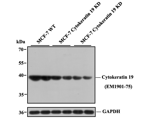 All lanes: Western blot analysis of Cytokeratin 19 with anti-Cytokeratin 19 antibody [A3D1] (EM1901-75) at 1/1,000 dilution.<br />
Lane 1/2: Wild-type MCF-7 whole cell lysate (20 µg).<br />
Lane 3/4: Cytokeratin 19 fragment 1 knockdown MCF-7 whole cell lysate (20 µg).<br />
Lane 5/6: Cytokeratin 19 fragment 2 knockdown MCF-7 whole cell lysate (20 µg).<br />
<br />
EM1901-75 was shown to specifically react with Cytokeratin 19 in wild-type MCF-7 cells. Weakened bands were observed when Cytokeratin 19 knockdown samples were tested. Wild-type and Cytokeratin 19 knockdown samples were subjected to SDS-PAGE. Proteins were transferred to a PVDF membrane and blocked with 5% NFDM in TBST for 1 hour at room temperature. The primary antibody (EM1901-75, 1/1,000) and Loading control antibody (Rabbit anti-GAPDH , ET1601-4, 1/10,000) were used in 5% BSA at room temperature for 2 hours. Goat Anti-Mouse IgG-HRP Secondary Antibody (HA1006) at 1:20,000 dilution was used for 1 hour at room temperature.
