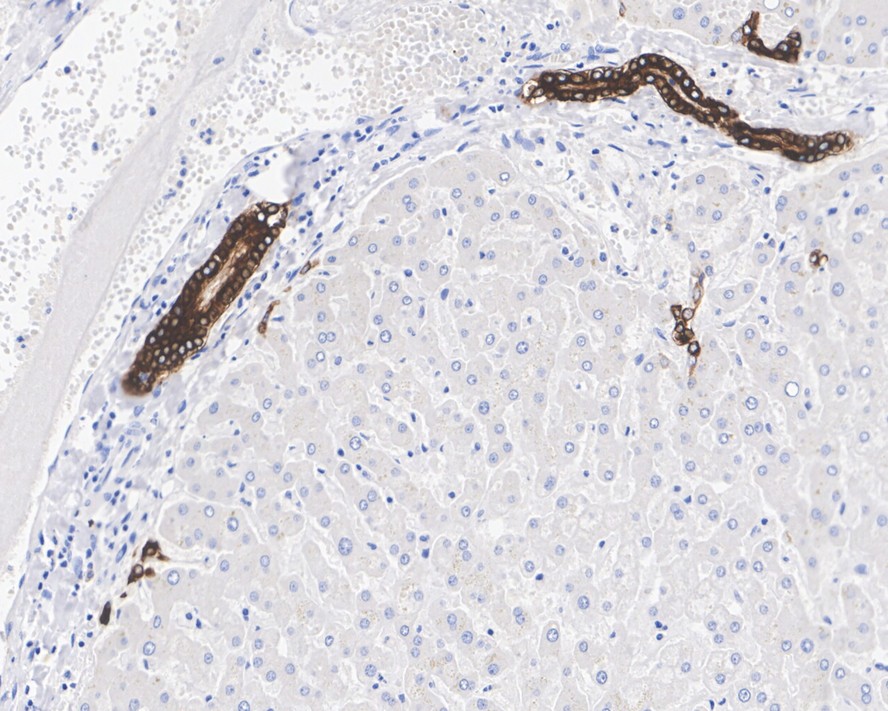 Immunohistochemical analysis of paraffin-embedded human small intestine tissue using anti-Cytokeratin 19 antibody. The section was pre-treated using heat mediated antigen retrieval with Tris-EDTA buffer (pH 8.0-8.4) for 20 minutes.The tissues were blocked in 5% BSA for 30 minutes at room temperature, washed with ddH2O and PBS, and then probed with the primary antibody (EM1901-75, 1/1,000) for 30 minutes at room temperature. The detection was performed using an HRP conjugated compact polymer system. DAB was used as the chromogen. Tissues were counterstained with hematoxylin and mounted with DPX.