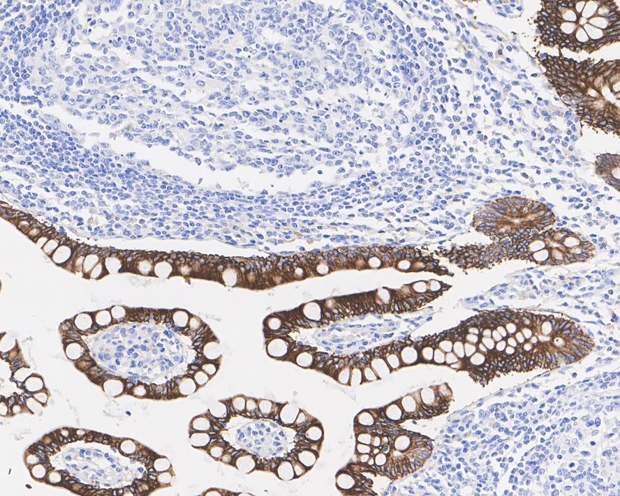 Immunohistochemical analysis of paraffin-embedded human pancreas tissue using anti-Cytokeratin 19 antibody. The section was pre-treated using heat mediated antigen retrieval with Tris-EDTA buffer (pH 8.0-8.4) for 20 minutes.The tissues were blocked in 5% BSA for 30 minutes at room temperature, washed with ddH2O and PBS, and then probed with the primary antibody (EM1901-75, 1/1,000) for 30 minutes at room temperature. The detection was performed using an HRP conjugated compact polymer system. DAB was used as the chromogen. Tissues were counterstained with hematoxylin and mounted with DPX.
