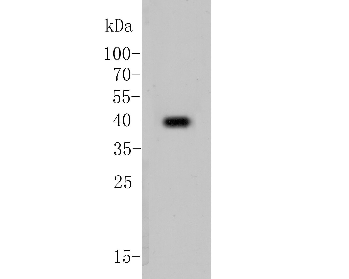 Western blot analysis of Cytokeratin 19 on MCF-7 cell lysate. Proteins were transferred to a PVDF membrane and blocked with 5% BSA in PBS for 1 hour at room temperature. The primary antibody (EM1901-76, 1/5,000) was used in 5% BSA at room temperature for 2 hours. Goat Anti-Mouse IgG - HRP Secondary Antibody (HA1006) at 1:5,000 dilution was used for 1 hour at room temperature.