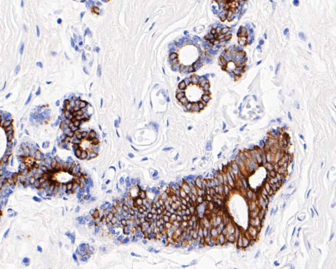 Immunohistochemical analysis of paraffin-embedded human small intestine tissue using anti-Cytokeratin 19 antibody. The section was pre-treated using heat mediated antigen retrieval with Tris-EDTA buffer (pH 8.0-8.4) for 20 minutes.The tissues were blocked in 5% BSA for 30 minutes at room temperature, washed with ddH2O and PBS, and then probed with the primary antibody (EM1901-76, 1/1000) for 30 minutes at room temperature. The detection was performed using an HRP conjugated compact polymer system. DAB was used as the chromogen. Tissues were counterstained with hematoxylin and mounted with DPX.