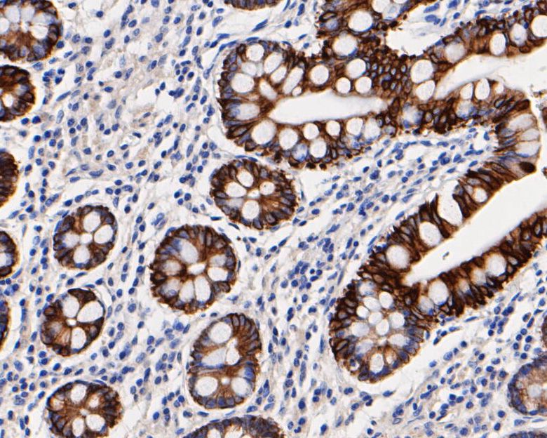 Immunohistochemical analysis of paraffin-embedded human small intestine tissue using anti-Cytokeratin 19 antibody. The section was pre-treated using heat mediated antigen retrieval with Tris-EDTA buffer (pH 8.0-8.4) for 20 minutes.The tissues were blocked in 5% BSA for 30 minutes at room temperature, washed with ddH2O and PBS, and then probed with the primary antibody (EM1901-76, 1/1,000) for 30 minutes at room temperature. The detection was performed using an HRP conjugated compact polymer system. DAB was used as the chromogen. Tissues were counterstained with hematoxylin and mounted with DPX.