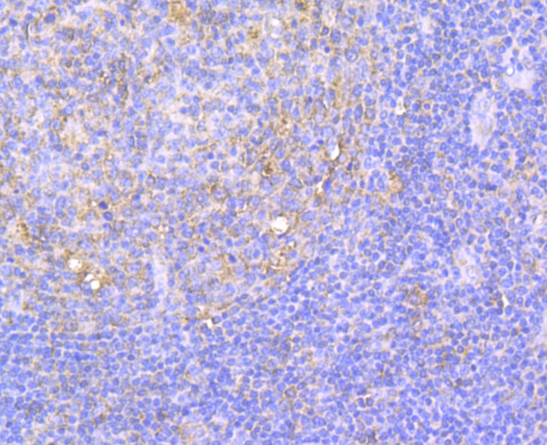 Immunohistochemical analysis of paraffin-embedded human tonsil tissue using anti-Integrin beta 1 antibody. The section was pre-treated using heat mediated antigen retrieval with Tris-EDTA buffer (pH 8.0-8.4) for 20 minutes.The tissues were blocked in 5% BSA for 30 minutes at room temperature, washed with ddH2O and PBS, and then probed with the antibody (EM1901-77) at 1/200 dilution, for 30 minutes at room temperature and detected using an HRP conjugated compact polymer system. DAB was used as the chromogen. Counter stained with hematoxylin and mounted with DPX
