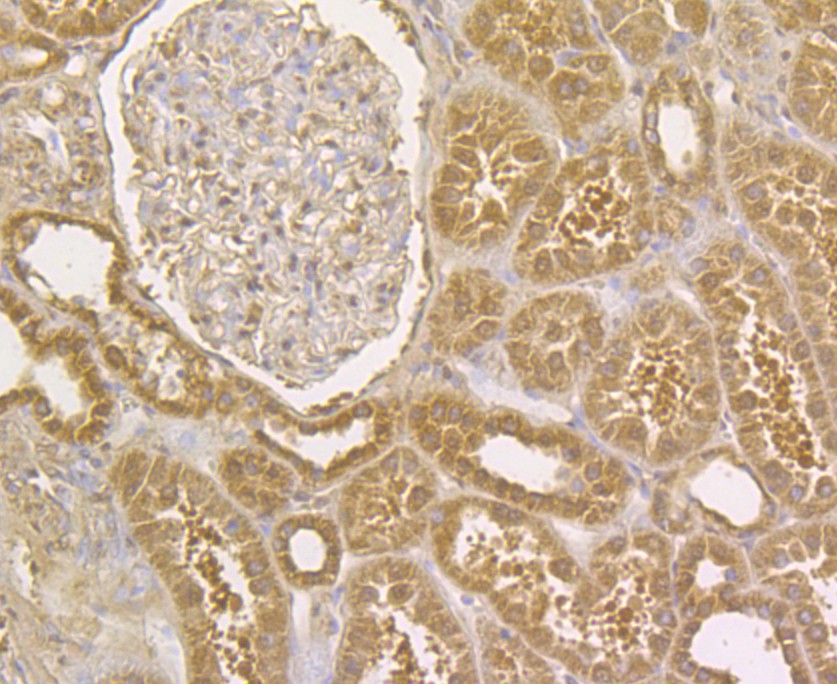 Immunohistochemical analysis of paraffin-embedded human kidney tissue using anti-Integrin beta 1 antibody. The section was pre-treated using heat mediated antigen retrieval with Tris-EDTA buffer (pH 8.0-8.4) for 20 minutes.The tissues were blocked in 5% BSA for 30 minutes at room temperature, washed with ddH2O and PBS, and then probed with the antibody (EM1901-77) at 1/50 dilution, for 30 minutes at room temperature and detected using an HRP conjugated compact polymer system. DAB was used as the chromogen. Counter stained with hematoxylin and mounted with DPX