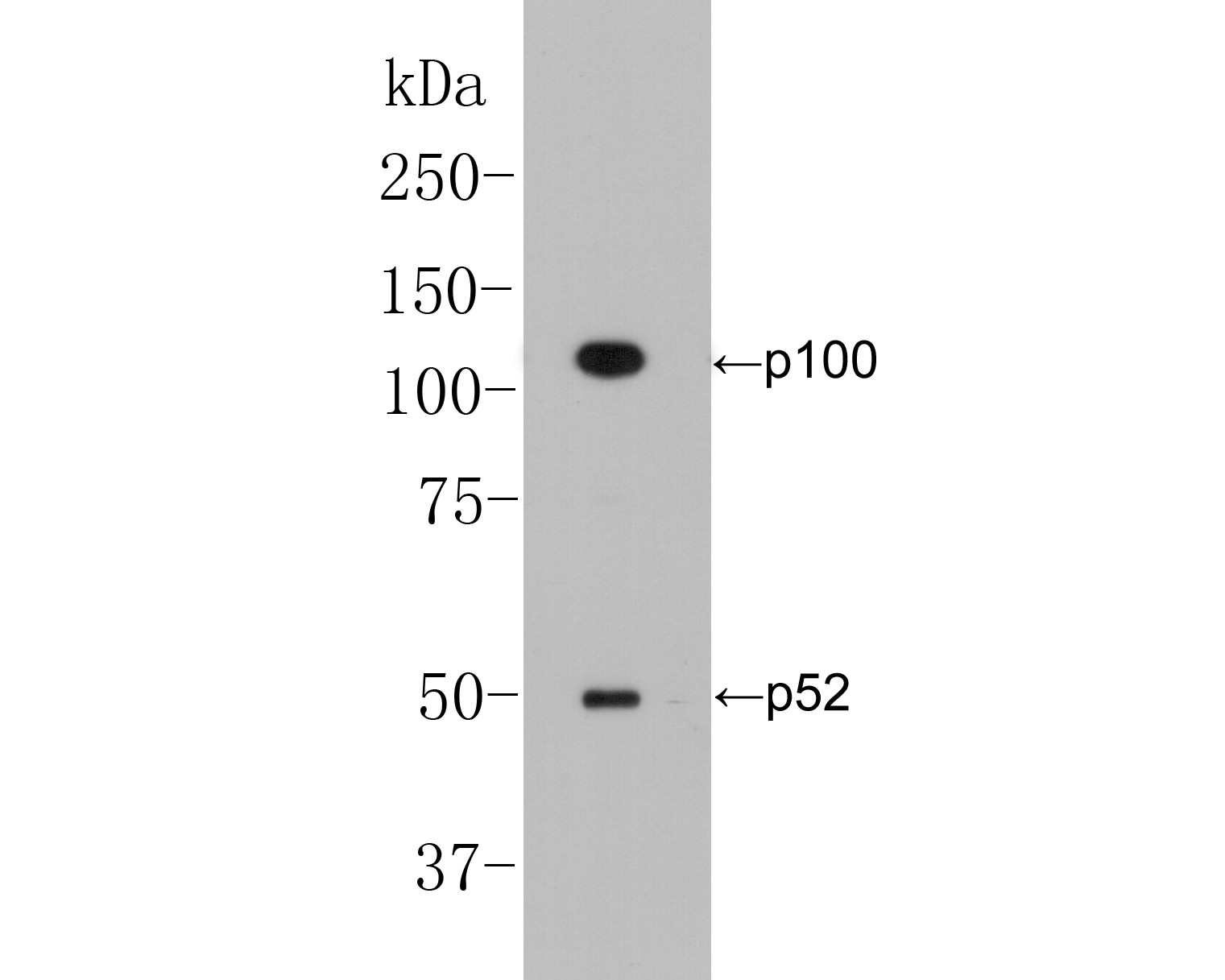 Western blot analysis of NFKB2 on Siha cell lysate. Proteins were transferred to a PVDF membrane and blocked with 5% BSA in PBS for 1 hour at room temperature. The primary antibody (EM1901-78, 1/500) was used in 5% BSA at room temperature for 2 hours. Goat Anti-Mouse IgG - HRP Secondary Antibody (HA1006) at 1:5,000 dilution was used for 1 hour at room temperature.<br />
Predicted band size: 97 kDa<br />
Observed band size: 52/100 kDa