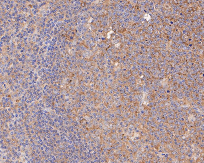Immunohistochemical analysis of paraffin-embedded human tonsil tissue using anti-NFKB2 antibody. The section was pre-treated using heat mediated antigen retrieval with Tris-EDTA buffer (pH 8.0-8.4) for 20 minutes.The tissues were blocked in 5% BSA for 30 minutes at room temperature, washed with ddH2O and PBS, and then probed with the primary antibody (EM1901-78, 1/100) for 30 minutes at room temperature. The detection was performed using an HRP conjugated compact polymer system. DAB was used as the chromogen. Tissues were counterstained with hematoxylin and mounted with DPX.
