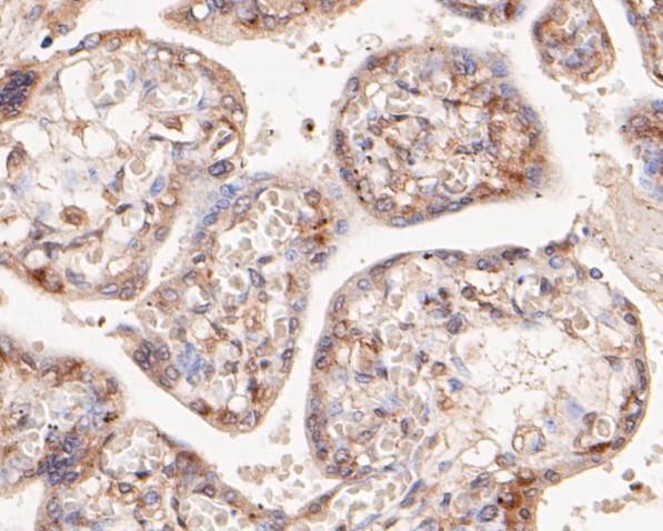 Immunohistochemical analysis of paraffin-embedded human placenta tissue using anti-NFKB2 antibody. The section was pre-treated using heat mediated antigen retrieval with Tris-EDTA buffer (pH 8.0-8.4) for 20 minutes.The tissues were blocked in 5% BSA for 30 minutes at room temperature, washed with ddH2O and PBS, and then probed with the primary antibody (EM1901-78, 1/200) for 30 minutes at room temperature. The detection was performed using an HRP conjugated compact polymer system. DAB was used as the chromogen. Tissues were counterstained with hematoxylin and mounted with DPX.