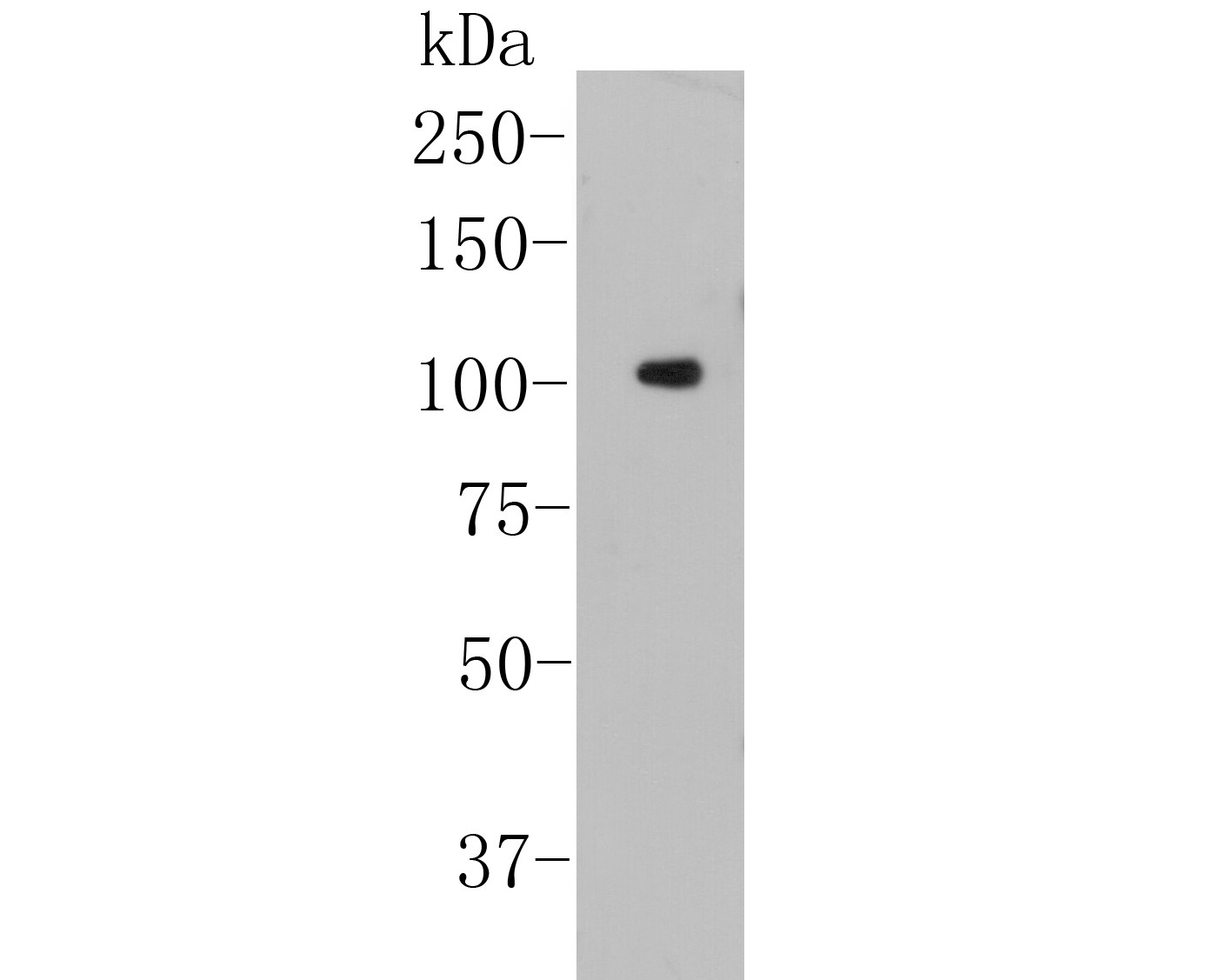 Western blot analysis of NFKB2 on A431 cell lysate. Proteins were transferred to a PVDF membrane and blocked with 5% BSA in PBS for 1 hour at room temperature. The primary antibody (EM1901-79, 1/500) was used in 5% BSA at room temperature for 2 hours. Goat Anti-Mouse IgG - HRP Secondary Antibody (HA1006) at 1:5,000 dilution was used for 1 hour at room temperature.<br />
Predicted band size: 97 kDa<br />
Observed band size: 100 kDa