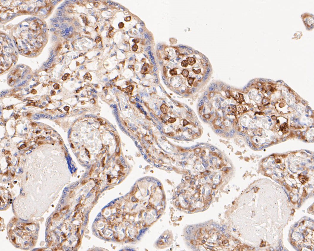 Immunohistochemical analysis of paraffin-embedded human placenta tissue using anti-NFKB2 antibody. The section was pre-treated using heat mediated antigen retrieval with Tris-EDTA buffer (pH 8.0-8.4) for 20 minutes.The tissues were blocked in 5% BSA for 30 minutes at room temperature, washed with ddH2O and PBS, and then probed with the primary antibody (EM1901-79, 1/50) for 30 minutes at room temperature. The detection was performed using an HRP conjugated compact polymer system. DAB was used as the chromogen. Tissues were counterstained with hematoxylin and mounted with DPX.