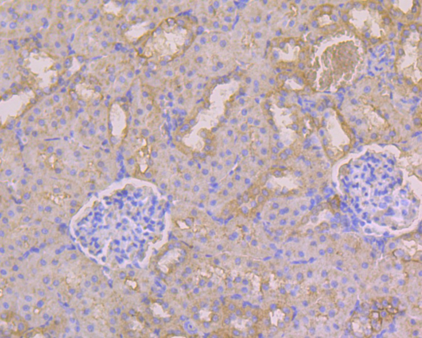 Immunohistochemical analysis of paraffin-embedded rat kidney tissue using anti-Albumin antibody. The section was pre-treated using heat mediated antigen retrieval with Tris-EDTA buffer (pH 8.0-8.4) for 20 minutes.The tissues were blocked in 5% BSA for 30 minutes at room temperature, washed with ddH2O and PBS, and then probed with the primary antibody (EM1901-80, 1/50) for 30 minutes at room temperature. The detection was performed using an HRP conjugated compact polymer system. DAB was used as the chromogen. Tissues were counterstained with hematoxylin and mounted with DPX.