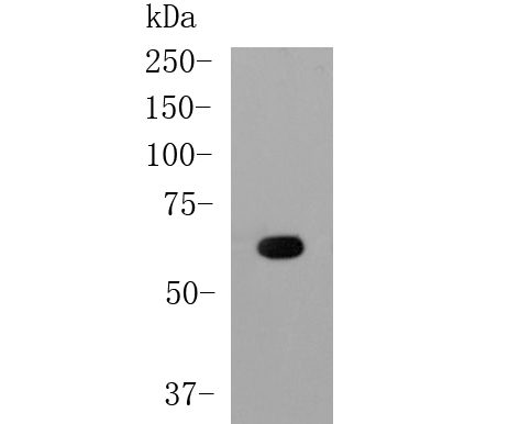 Western blot analysis of Albumin on human plasma sample. Proteins were transferred to a PVDF membrane and blocked with 5% BSA in PBS for 1 hour at room temperature. The primary antibody (EM1901-81, 1/50000) was used in 5% BSA at room temperature for 2 hours. Goat Anti-Mouse IgG - HRP Secondary Antibody (HA1006) at 1:5,000 dilution was used for 1 hour at room temperature.