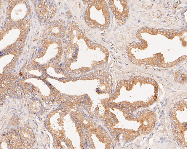 ICC staining of CAPZA1 in SiHa cells (green). Formalin fixed cells were permeabilized with 0.1% Triton X-100 in TBS for 10 minutes at room temperature and blocked with 1% Blocker BSA for 15 minutes at room temperature. Cells were probed with the primary antibody (EM1901-82, 1/50) for 1 hour at room temperature, washed with PBS. Alexa Fluor®488 Goat anti-Mouse IgG was used as the secondary antibody at 1/1,000 dilution. The nuclear counter stain is DAPI (blue).