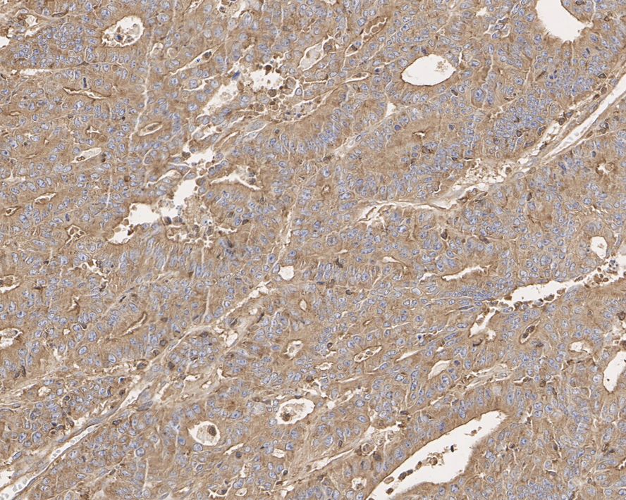 Immunohistochemical analysis of paraffin-embedded human kidney tissue using anti-CAPZA1 antibody. The section was pre-treated using heat mediated antigen retrieval with Tris-EDTA buffer (pH 8.0-8.4) for 20 minutes.The tissues were blocked in 5% BSA for 30 minutes at room temperature, washed with ddH2O and PBS, and then probed with the primary antibody (EM1901-82, 1/50) for 30 minutes at room temperature. The detection was performed using an HRP conjugated compact polymer system. DAB was used as the chromogen. Tissues were counterstained with hematoxylin and mounted with DPX.