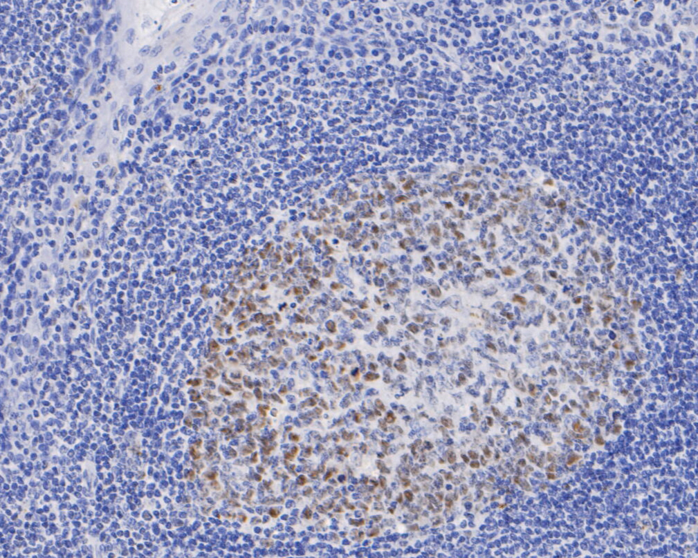 Immunohistochemical analysis of paraffin-embedded human tonsil tissue using anti-DNMT1 antibody. The section was pre-treated using heat mediated antigen retrieval with sodium citrate buffer (pH 6.0) for 20 minutes. The tissues were blocked in 5% BSA for 30 minutes at room temperature, washed with ddH2O and PBS, and then probed with the primary antibody (EM1901-84, 1/50)  for 30 minutes at room temperature. The detection was performed using an HRP conjugated compact polymer system. DAB was used as the chromogen. Tissues were counterstained with hematoxylin and mounted with DPX.