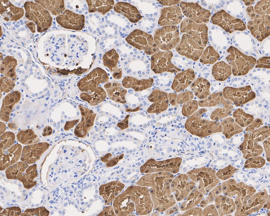 Immunohistochemical analysis of paraffin-embedded human liver tissue using anti-ACY1 antibody. The section was pre-treated using heat mediated antigen retrieval with Tris-EDTA buffer (pH 8.0-8.4) for 20 minutes.The tissues were blocked in 5% BSA for 30 minutes at room temperature, washed with ddH2O and PBS, and then probed with the primary antibody (EM1901-86, 1/50) for 30 minutes at room temperature. The detection was performed using an HRP conjugated compact polymer system. DAB was used as the chromogen. Tissues were counterstained with hematoxylin and mounted with DPX.