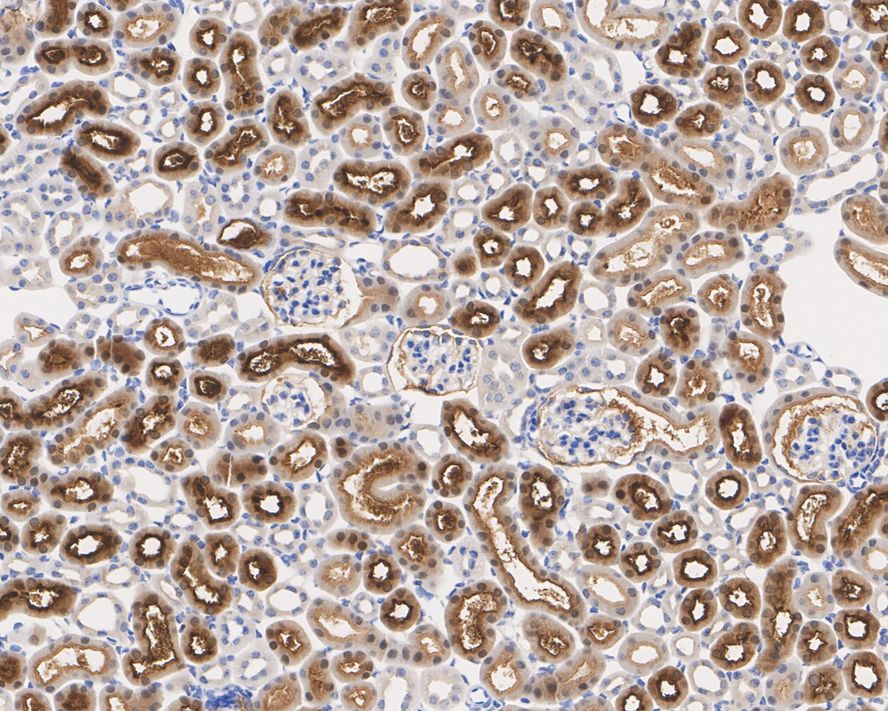 Immunohistochemical analysis of paraffin-embedded human kidney tissue using anti-ACY1 antibody. The section was pre-treated using heat mediated antigen retrieval with Tris-EDTA buffer (pH 8.0-8.4) for 20 minutes.The tissues were blocked in 5% BSA for 30 minutes at room temperature, washed with ddH2O and PBS, and then probed with the primary antibody (EM1901-86, 1/100) for 30 minutes at room temperature. The detection was performed using an HRP conjugated compact polymer system. DAB was used as the chromogen. Tissues were counterstained with hematoxylin and mounted with DPX.