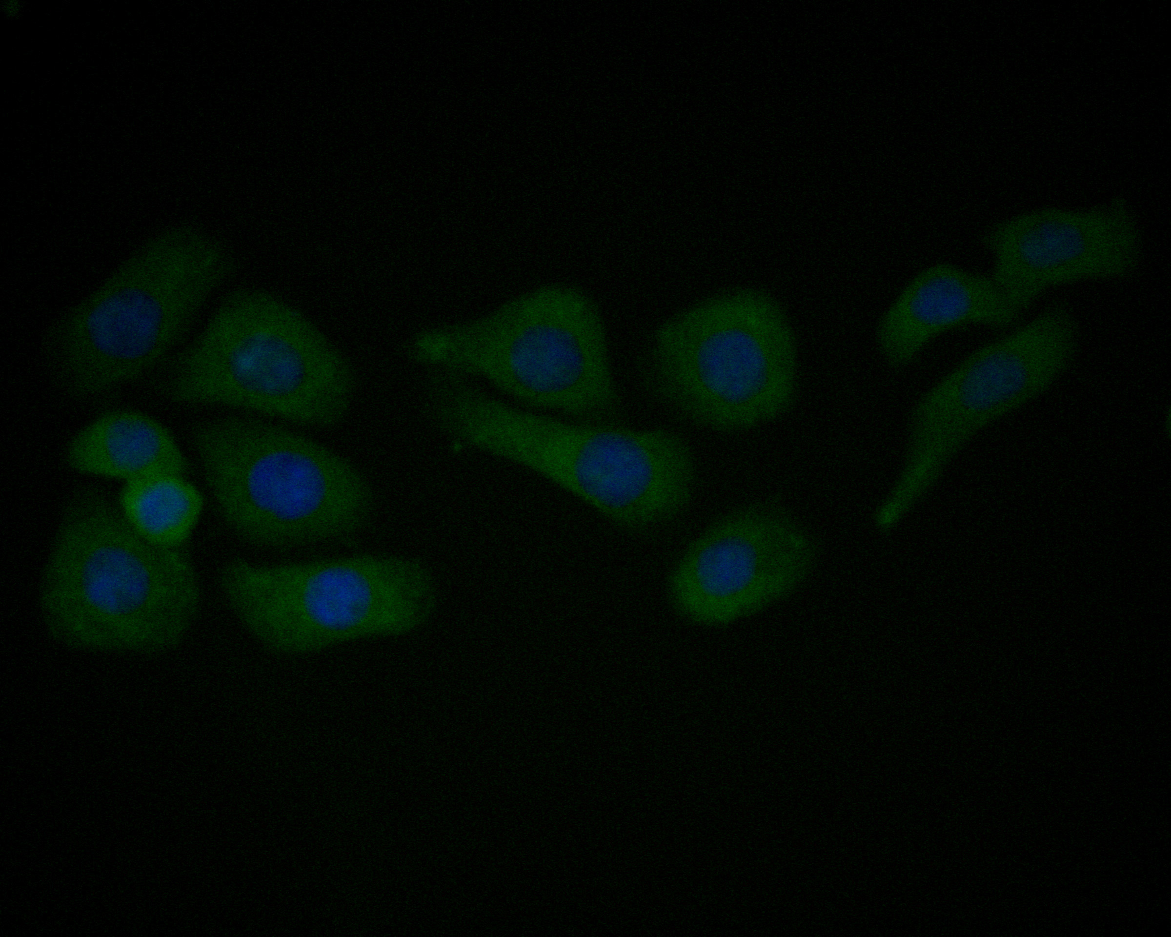 ICC staining of Caveolin-1 in SKOV-3 cells (green). Formalin fixed cells were permeabilized with 0.1% Triton X-100 in TBS for 10 minutes at room temperature and blocked with 1% Blocker BSA for 15 minutes at room temperature. Cells were probed with the primary antibody (EM1901-87, 1/50) for 1 hour at room temperature, washed with PBS. Alexa Fluor®488 Goat anti-Mouse IgG was used as the secondary antibody at 1/1,000 dilution. The nuclear counter stain is DAPI (blue).