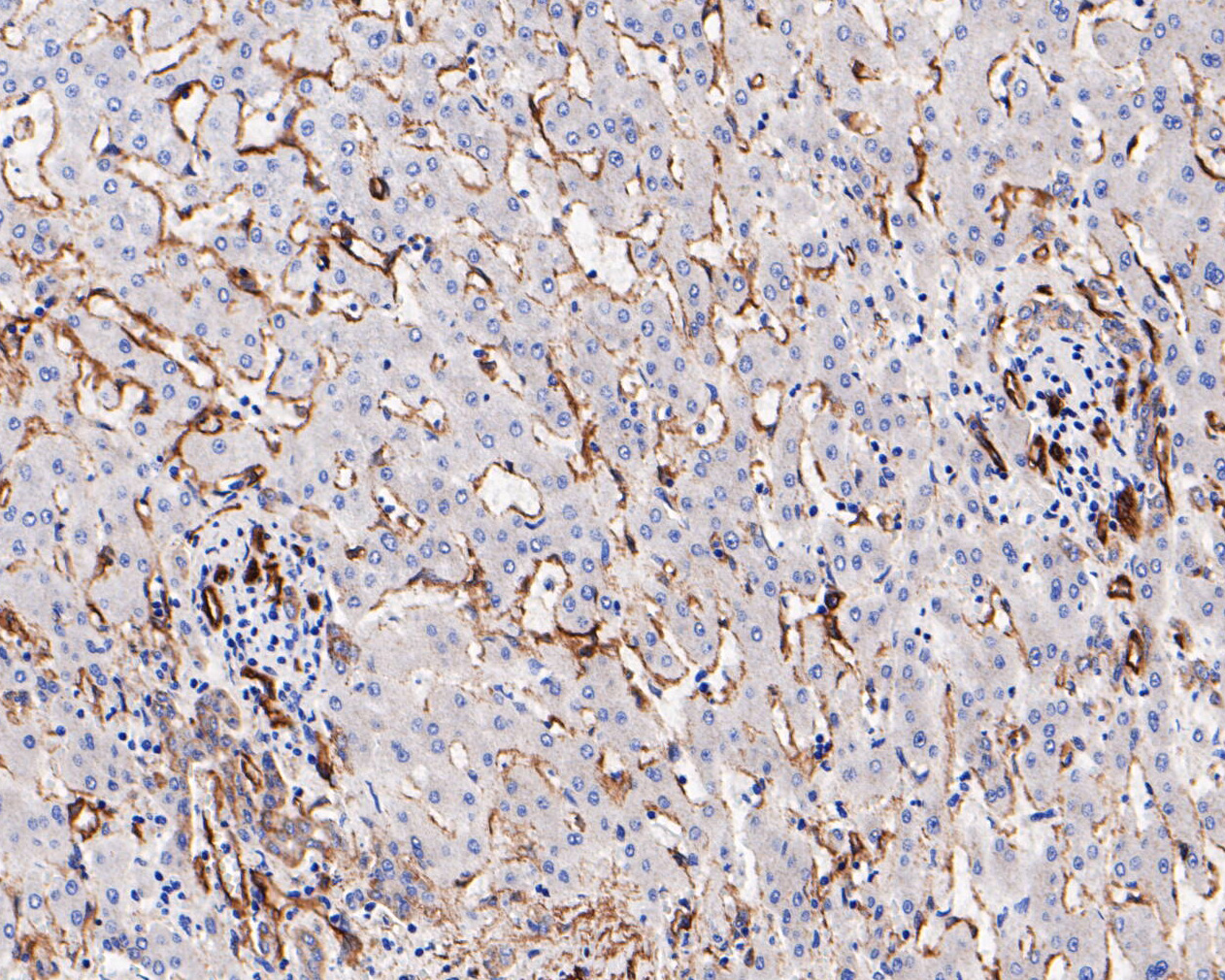 Immunohistochemical analysis of paraffin-embedded human liver tissue using anti-Caveolin-1 antibody. The section was pre-treated using heat mediated antigen retrieval with Tris-EDTA buffer (pH 8.0-8.4) for 20 minutes.The tissues were blocked in 5% BSA for 30 minutes at room temperature, washed with ddH2O and PBS, and then probed with the primary antibody (EM1901-87, 1/800) for 30 minutes at room temperature. The detection was performed using an HRP conjugated compact polymer system. DAB was used as the chromogen. Tissues were counterstained with hematoxylin and mounted with DPX.