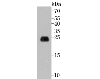 Western blot analysis of Caveolin-1 on SiHa cell lysates. Proteins were transferred to a PVDF membrane and blocked with 5% BSA in PBS for 1 hour at room temperature. The primary antibody (EM1901-88, 1/500) was used in 5% BSA at room temperature for 2 hours. Goat Anti-Mouse IgG - HRP Secondary Antibody (HA1006) at 1:5,000 dilution was used for 1 hour at room temperature.