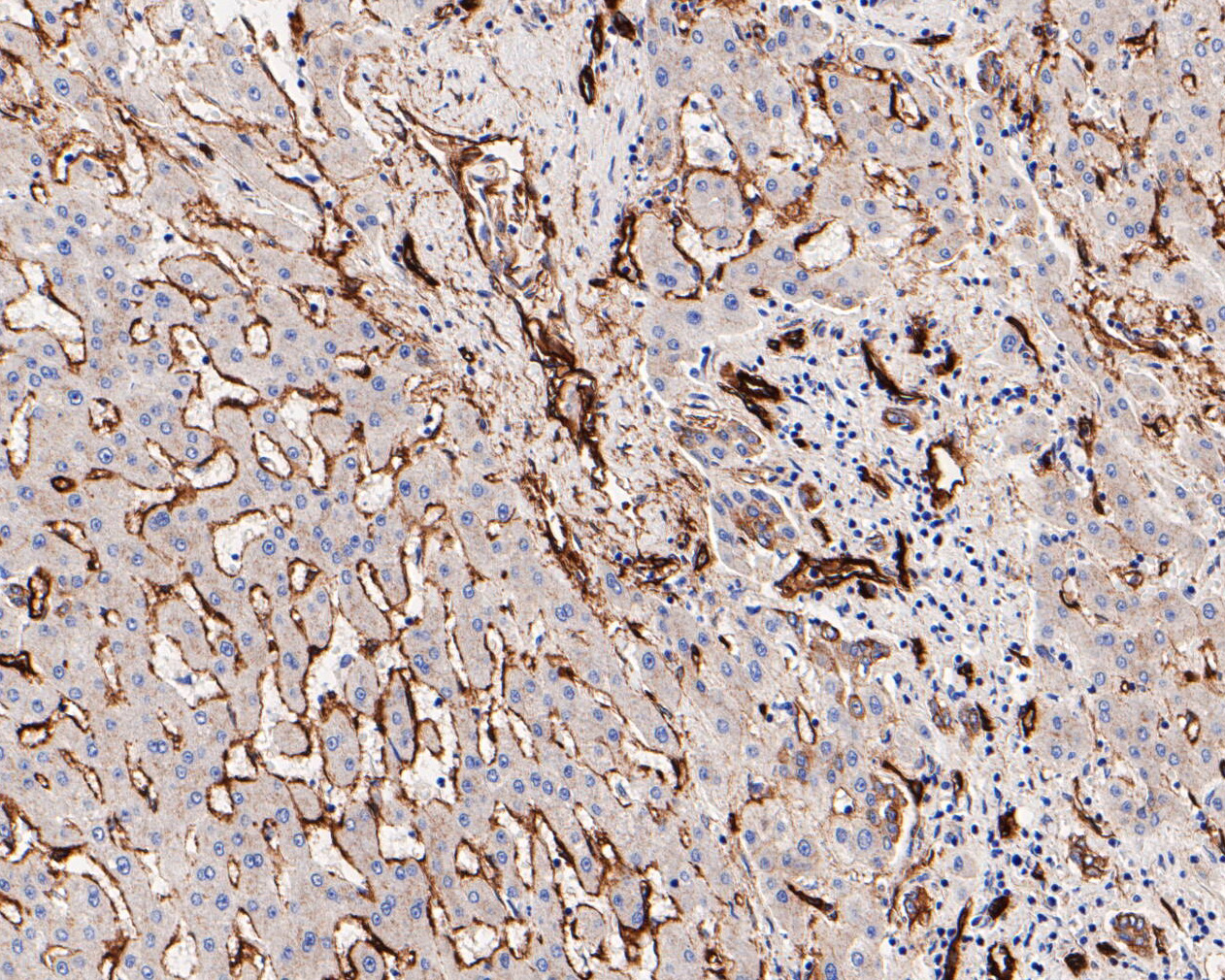 Immunohistochemical analysis of paraffin-embedded human liver tissue using anti-Caveolin-1 antibody. The section was pre-treated using heat mediated antigen retrieval with Tris-EDTA buffer (pH 8.0-8.4) for 20 minutes.The tissues were blocked in 5% BSA for 30 minutes at room temperature, washed with ddH2O and PBS, and then probed with the primary antibody (EM1901-88, 1/800) for 30 minutes at room temperature. The detection was performed using an HRP conjugated compact polymer system. DAB was used as the chromogen. Tissues were counterstained with hematoxylin and mounted with DPX.