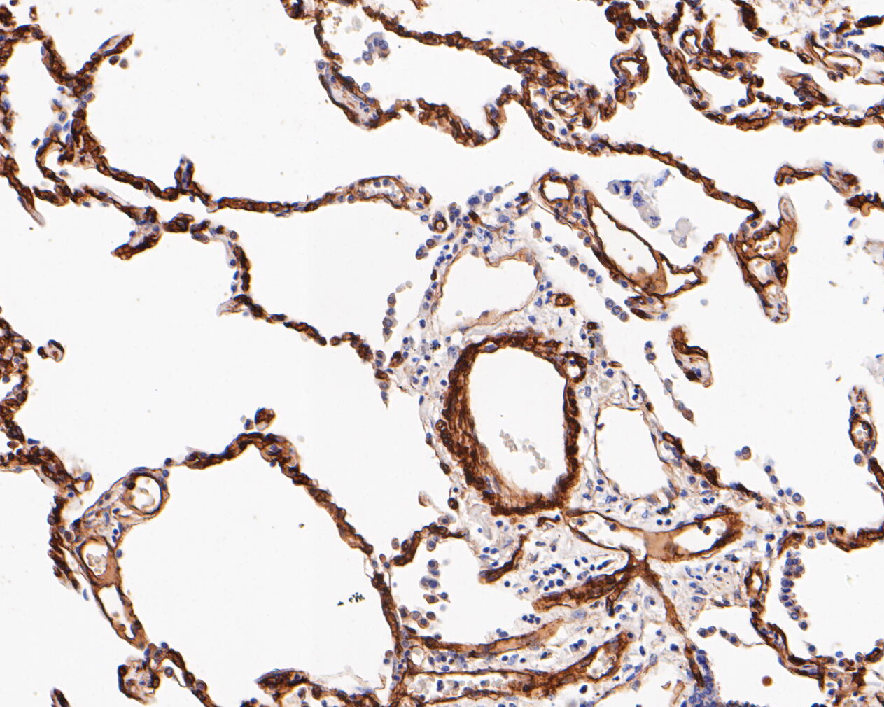 Immunohistochemical analysis of paraffin-embedded human lung tissue using anti-Caveolin-1 antibody. The section was pre-treated using heat mediated antigen retrieval with Tris-EDTA buffer (pH 8.0-8.4) for 20 minutes.The tissues were blocked in 5% BSA for 30 minutes at room temperature, washed with ddH2O and PBS, and then probed with the primary antibody (EM1901-88, 1/2,000) for 30 minutes at room temperature. The detection was performed using an HRP conjugated compact polymer system. DAB was used as the chromogen. Tissues were counterstained with hematoxylin and mounted with DPX.