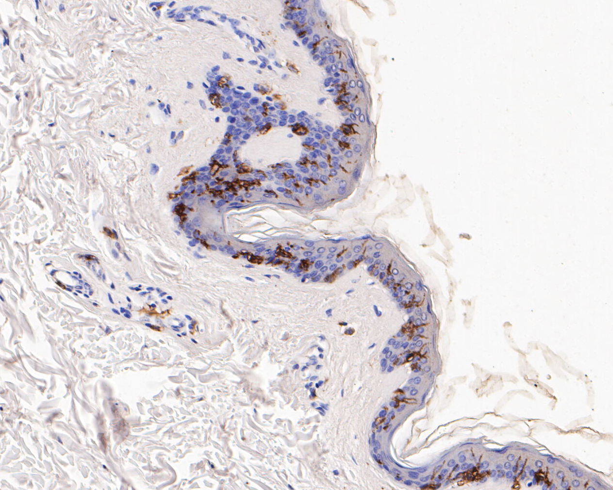 Immunohistochemical analysis of paraffin-embedded human skin tissue using anti-CD1A antibody. The section was pre-treated using heat mediated antigen retrieval with Tris-EDTA buffer (pH 8.0-8.4) for 20 minutes.The tissues were blocked in 5% BSA for 30 minutes at room temperature, washed with ddH2O and PBS, and then probed with the primary antibody (EM1901-89, 1/400) for 30 minutes at room temperature. The detection was performed using an HRP conjugated compact polymer system. DAB was used as the chromogen. Tissues were counterstained with hematoxylin and mounted with DPX.