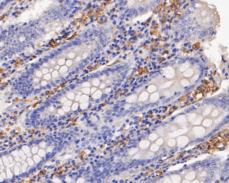 Immunohistochemical analysis of paraffin-embedded human colom tissue using anti-CD163 antibody. The section was pre-treated using heat mediated antigen retrieval with Tris-EDTA buffer (pH 8.0-8.4) for 20 minutes.The tissues were blocked in 5% BSA for 30 minutes at room temperature, washed with ddH2O and PBS, and then probed with the primary antibody (EM1901-90, 1/200) for 30 minutes at room temperature. The detection was performed using an HRP conjugated compact polymer system. DAB was used as the chromogen. Tissues were counterstained with hematoxylin and mounted with DPX.