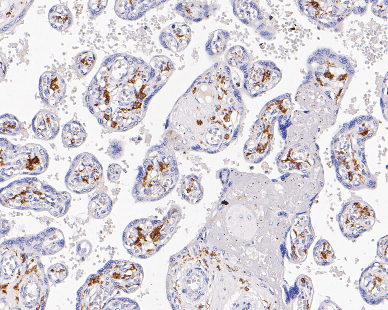 Immunohistochemical analysis of paraffin-embedded human placenta tissue using anti-CD163 antibody. The section was pre-treated using heat mediated antigen retrieval with Tris-EDTA buffer (pH 8.0-8.4) for 20 minutes.The tissues were blocked in 5% BSA for 30 minutes at room temperature, washed with ddH2O and PBS, and then probed with the primary antibody (EM1901-91, 1/200) for 30 minutes at room temperature. The detection was performed using an HRP conjugated compact polymer system. DAB was used as the chromogen. Tissues were counterstained with hematoxylin and mounted with DPX.