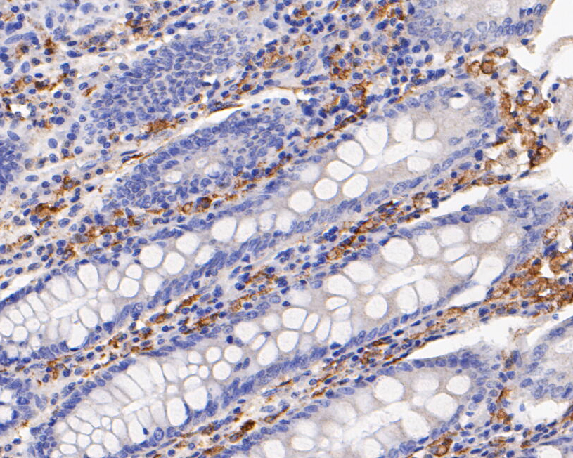 Immunohistochemical analysis of paraffin-embedded human colon tissue using anti-CD163 antibody. The section was pre-treated using heat mediated antigen retrieval with Tris-EDTA buffer (pH 8.0-8.4) for 20 minutes.The tissues were blocked in 5% BSA for 30 minutes at room temperature, washed with ddH2O and PBS, and then probed with the primary antibody (EM1901-91, 1/200) for 30 minutes at room temperature. The detection was performed using an HRP conjugated compact polymer system. DAB was used as the chromogen. Tissues were counterstained with hematoxylin and mounted with DPX.