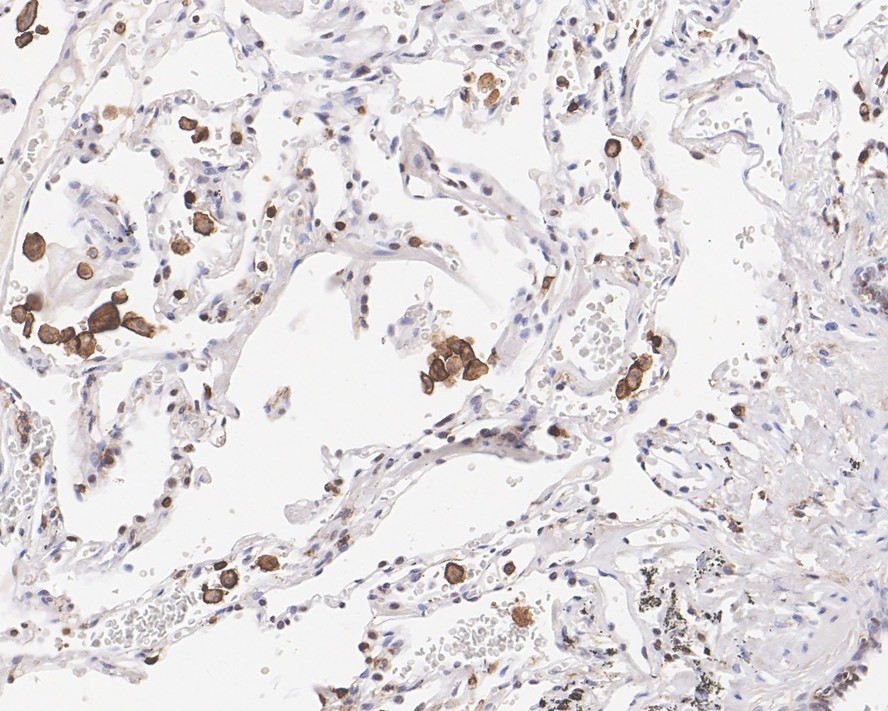 Immunohistochemical analysis of paraffin-embedded human tonsil tissue using anti-CD43 antibody. The section was pre-treated using heat mediated antigen retrieval with sodium citrate buffer (pH 6.0) for 20 minutes. The tissues were blocked in 5% BSA for 30 minutes at room temperature, washed with ddH2O and PBS, and then probed with the primary antibody (EM1901-92, 1/200)  for 30 minutes at room temperature. The detection was performed using an HRP conjugated compact polymer system. DAB was used as the chromogen. Tissues were counterstained with hematoxylin and mounted with DPX.