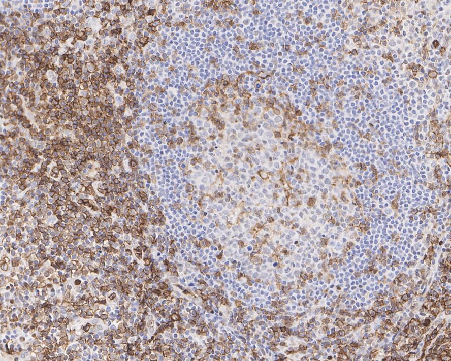 Immunohistochemical analysis of paraffin-embedded human spleen tissue using anti-CD43 antibody. The section was pre-treated using heat mediated antigen retrieval with sodium citrate buffer (pH 6.0) for 20 minutes. The tissues were blocked in 5% BSA for 30 minutes at room temperature, washed with ddH2O and PBS, and then probed with the primary antibody (EM1901-92, 1/200)  for 30 minutes at room temperature. The detection was performed using an HRP conjugated compact polymer system. DAB was used as the chromogen. Tissues were counterstained with hematoxylin and mounted with DPX.