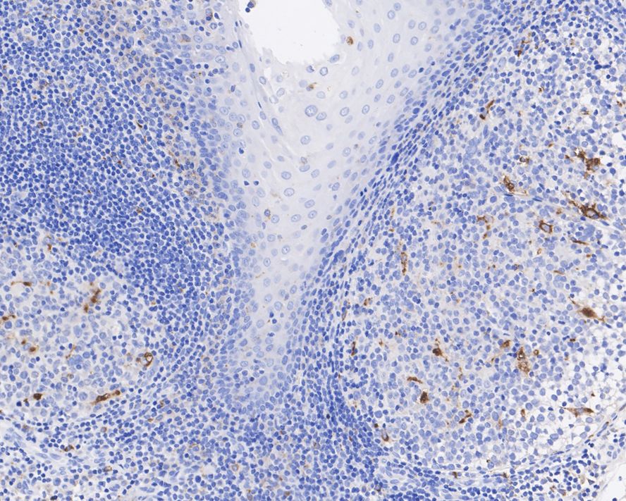 Immunohistochemical analysis of paraffin-embedded human tonsil tissue using anti-CD68 antibody. The section was pre-treated using heat mediated antigen retrieval with Tris-EDTA buffer (pH 8.0-8.4) for 20 minutes.The tissues were blocked in 5% BSA for 30 minutes at room temperature, washed with ddH2O and PBS, and then probed with the primary antibody (EM1901-93, 1/200) for 30 minutes at room temperature. The detection was performed using an HRP conjugated compact polymer system. DAB was used as the chromogen. Tissues were counterstained with hematoxylin and mounted with DPX.