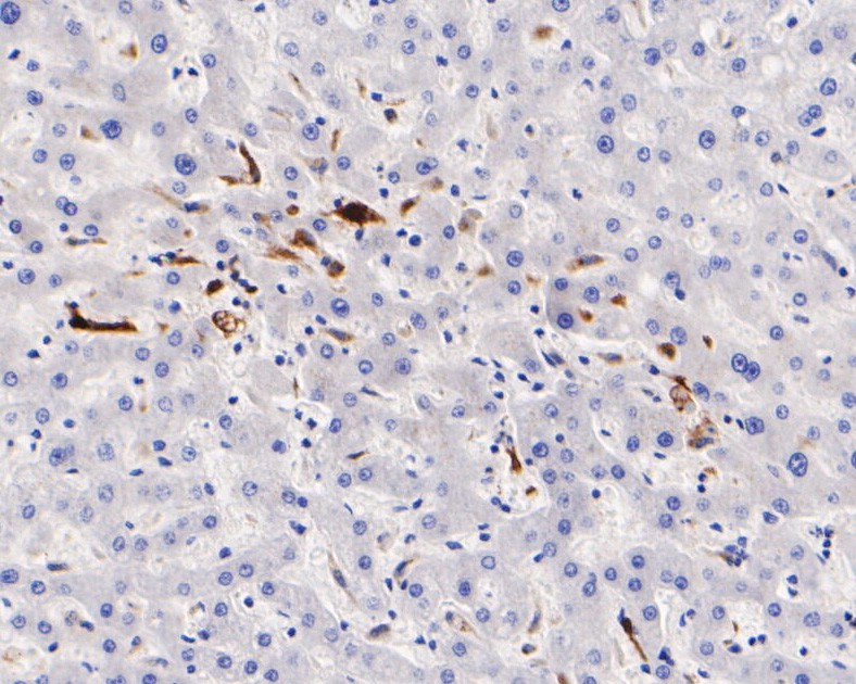 Immunohistochemical analysis of paraffin-embedded human liver tissue using anti-CD68 antibody. The section was pre-treated using heat mediated antigen retrieval with Tris-EDTA buffer (pH 8.0-8.4) for 20 minutes.The tissues were blocked in 5% BSA for 30 minutes at room temperature, washed with ddH2O and PBS, and then probed with the primary antibody (EM1901-93, 1/200) for 30 minutes at room temperature. The detection was performed using an HRP conjugated compact polymer system. DAB was used as the chromogen. Tissues were counterstained with hematoxylin and mounted with DPX.