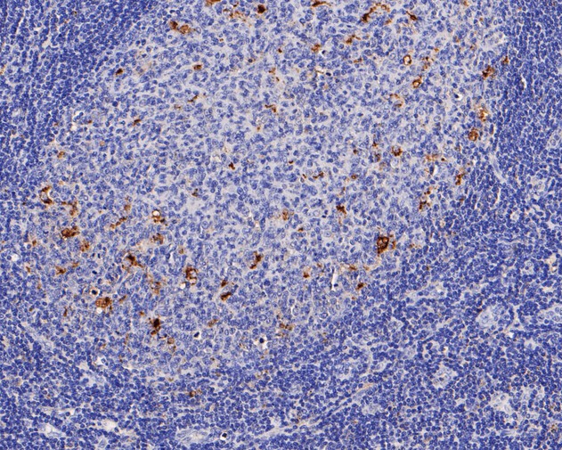 Immunohistochemical analysis of paraffin-embedded human tonsil tissue using anti-CD68 antibody. The section was pre-treated using heat mediated antigen retrieval with Tris-EDTA buffer (pH 8.0-8.4) for 20 minutes.The tissues were blocked in 5% BSA for 30 minutes at room temperature, washed with ddH2O and PBS, and then probed with the primary antibody (EM1901-94, 1/200) for 30 minutes at room temperature. The detection was performed using an HRP conjugated compact polymer system. DAB was used as the chromogen. Tissues were counterstained with hematoxylin and mounted with DPX.