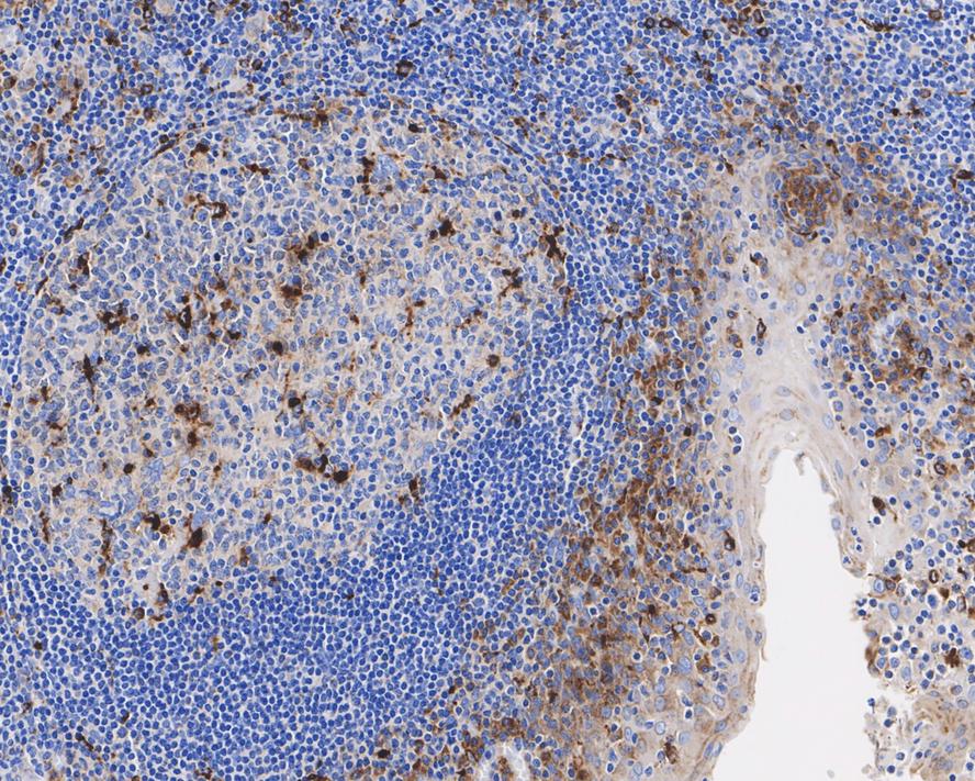 Immunohistochemical analysis of paraffin-embedded human tonsil tissue using anti-CD68 antibody. The section was pre-treated using heat mediated antigen retrieval with Tris-EDTA buffer (pH 8.0-8.4) for 20 minutes.The tissues were blocked in 5% BSA for 30 minutes at room temperature, washed with ddH2O and PBS, and then probed with the primary antibody (EM1901-95, 1/200) for 30 minutes at room temperature. The detection was performed using an HRP conjugated compact polymer system. DAB was used as the chromogen. Tissues were counterstained with hematoxylin and mounted with DPX.