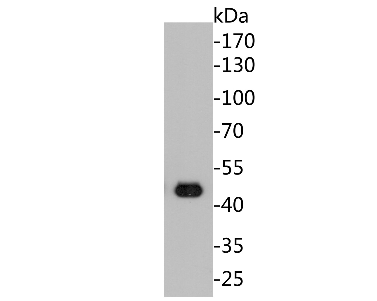 Western blot analysis of Cytokeratin 20 on Lovo cell lysates. Proteins were transferred to a PVDF membrane and blocked with 5% BSA in PBS for 1 hour at room temperature. The primary antibody (EM1901-96, 1/500) was used in 5% BSA at room temperature for 2 hours. Goat Anti-Mouse IgG - HRP Secondary Antibody (HA1006) at 1:5,000 dilution was used for 1 hour at room temperature.