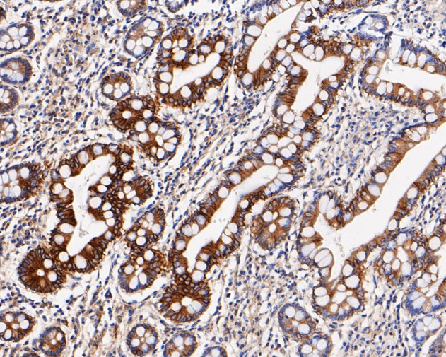 Immunohistochemical analysis of paraffin-embedded human small intestine tissue using anti-Cytokeratin 20 antibody. The section was pre-treated using heat mediated antigen retrieval with Tris-EDTA buffer (pH 8.0-8.4) for 20 minutes.The tissues were blocked in 5% BSA for 30 minutes at room temperature, washed with ddH2O and PBS, and then probed with the primary antibody (EM1901-96, 1/400) for 30 minutes at room temperature. The detection was performed using an HRP conjugated compact polymer system. DAB was used as the chromogen. Tissues were counterstained with hematoxylin and mounted with DPX.