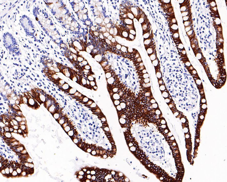 Immunohistochemical analysis of paraffin-embedded human small intestine tissue with Mouse anti-Cytokeratin 20 antibody (EM1901-97) at 1/1,000 dilution.<br />
<br />
The section was pre-treated using heat mediated antigen retrieval with Tris-EDTA buffer (pH 9.0) for 20 minutes. The tissues were blocked in 1% BSA for 20 minutes at room temperature, washed with ddH2O and PBS, and then probed with the primary antibody (EM1901-97) at 1/1,000 dilution for 1 hour at room temperature. The detection was performed using an HRP conjugated compact polymer system. DAB was used as the chromogen. Tissues were counterstained with hematoxylin and mounted with DPX.