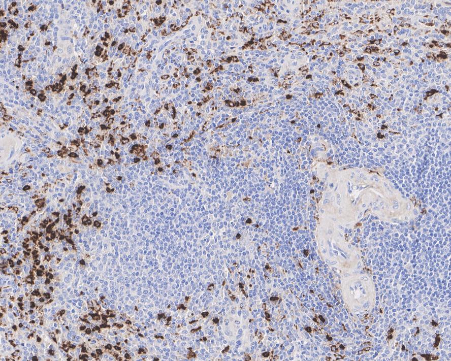 Immunohistochemical analysis of paraffin-embedded human spleen tissue using anti-Lysozyme antibody. The section was pre-treated using heat mediated antigen retrieval with Tris-EDTA buffer (pH 8.0-8.4) for 20 minutes.The tissues were blocked in 5% BSA for 30 minutes at room temperature, washed with ddH2O and PBS, and then probed with the primary antibody (EM1901-98, 1/1,000) for 30 minutes at room temperature. The detection was performed using an HRP conjugated compact polymer system. DAB was used as the chromogen. Tissues were counterstained with hematoxylin and mounted with DPX.