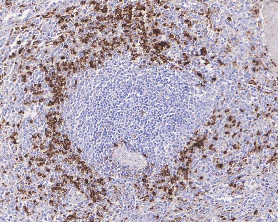 Immunohistochemical analysis of paraffin-embedded human spleen tissue using anti-Lysozyme antibody. The section was pre-treated using heat mediated antigen retrieval with Tris-EDTA buffer (pH 8.0-8.4) for 20 minutes.The tissues were blocked in 5% BSA for 30 minutes at room temperature, washed with ddH2O and PBS, and then probed with the primary antibody (EM1901-99, 1/500) for 30 minutes at room temperature. The detection was performed using an HRP conjugated compact polymer system. DAB was used as the chromogen. Tissues were counterstained with hematoxylin and mounted with DPX.