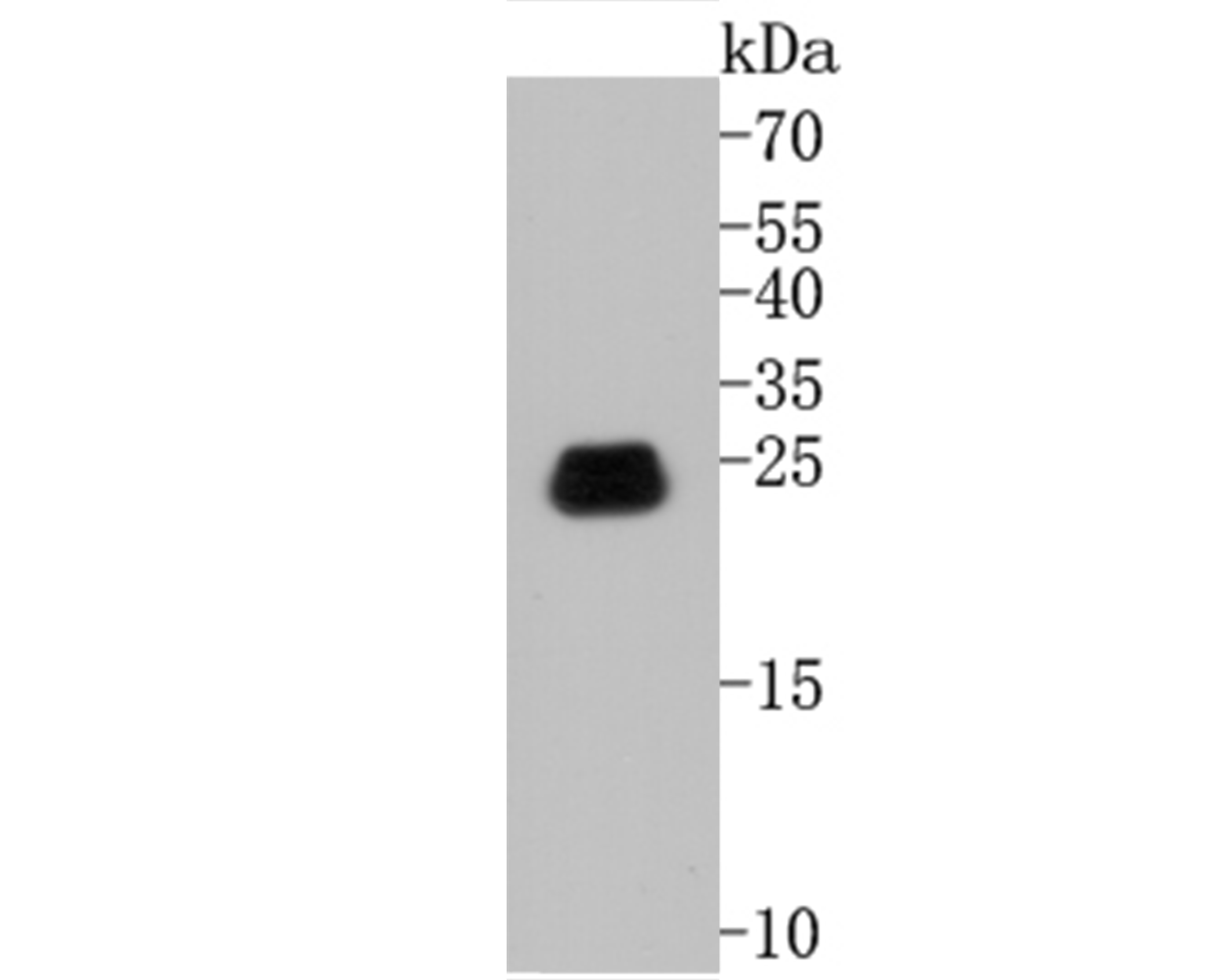 Western blot analysis of Caveolin-1 on SiHa cell lysates. Proteins were transferred to a PVDF membrane and blocked with 5% BSA in PBS for 1 hour at room temperature. The primary antibody (EM1902-01, 1/500) was used in 5% BSA at room temperature for 2 hours. Goat Anti-Mouse IgG - HRP Secondary Antibody (HA1006) at 1:5,000 dilution was used for 1 hour at room temperature.